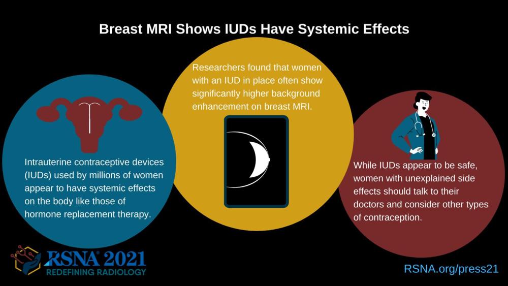 Breast MRI Shows IUDs Have Systemic Effects